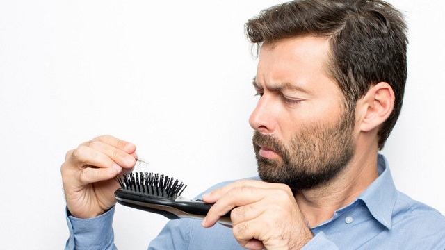 Berikut Ini Cara Mencegah Kerontokan Rambut Pada Pria